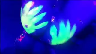 تجميع الشرج فن