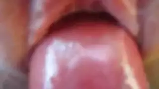 طبي اللغة الفارسية الحلمات